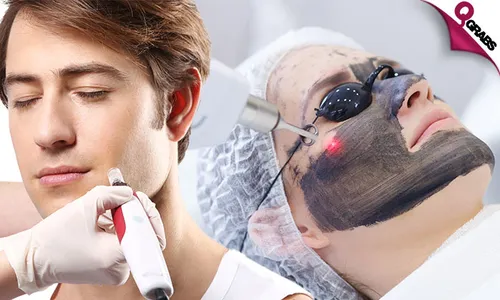 Carbon Peel, Micro-Needling RF, Derma Pen Mesotherapy & More!